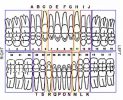 Human Teeth Dental Charts - Bradford Family Dentistry