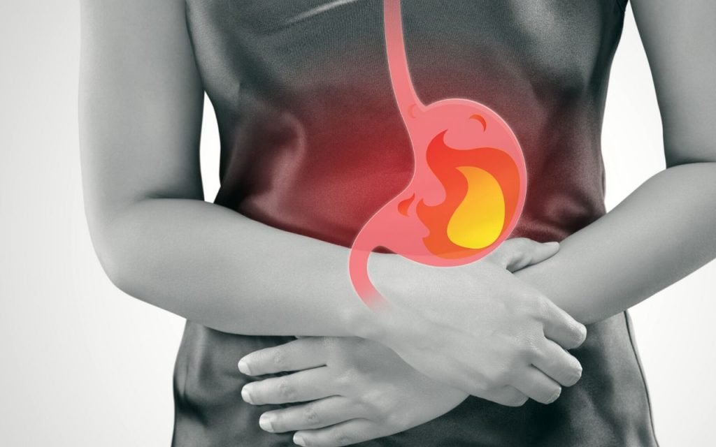 Acid Reflux and Your Oral Health Bradford Family Dentistry