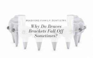 why-do-braces-brackets-fall-off-sometimes-Bradford-Family-Dentistry
