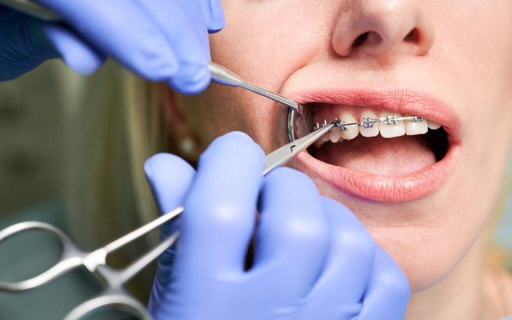 how often are braces adjusted what does a typical orthodontic visit