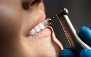 is-it-possible-to-get-the-same-feeling-of-smooth-teeth-after-a-dental-cleaning-at-home