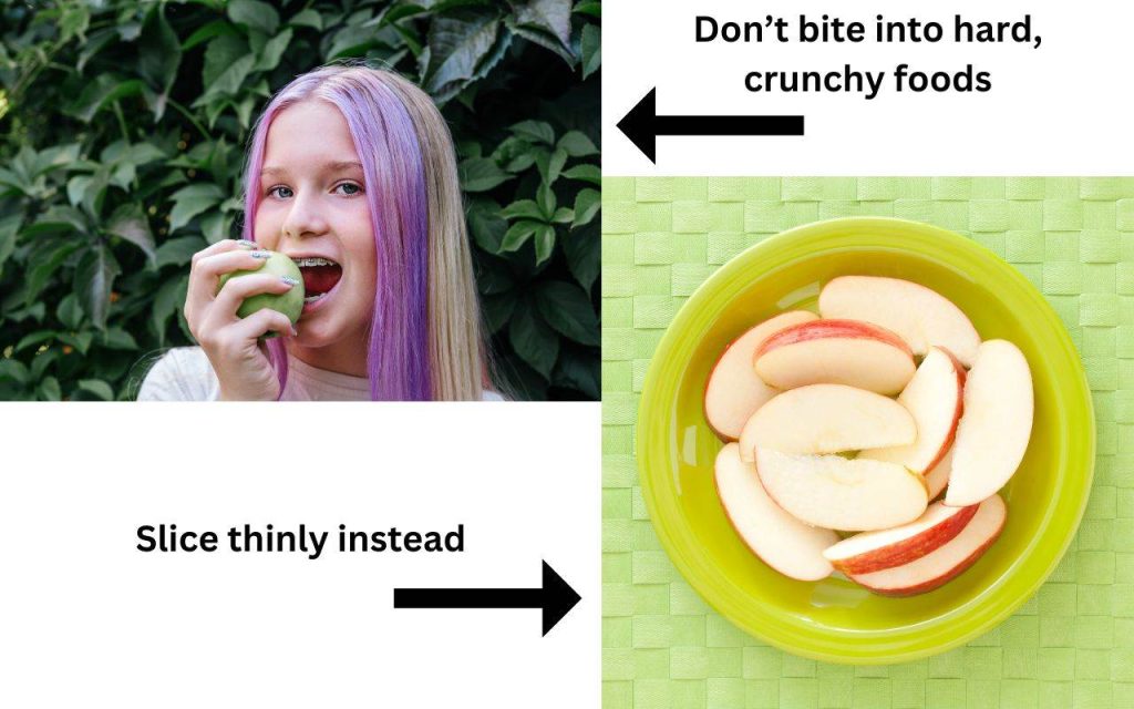 How To Eat With Braces Comfortably - Bradford Family Dentistry